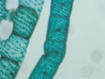 MISSING THUMBNAIL